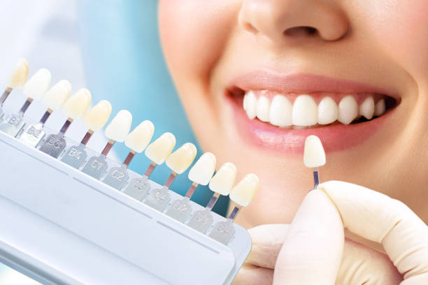 Dental crowns