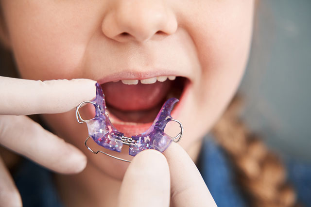 Dental crowns