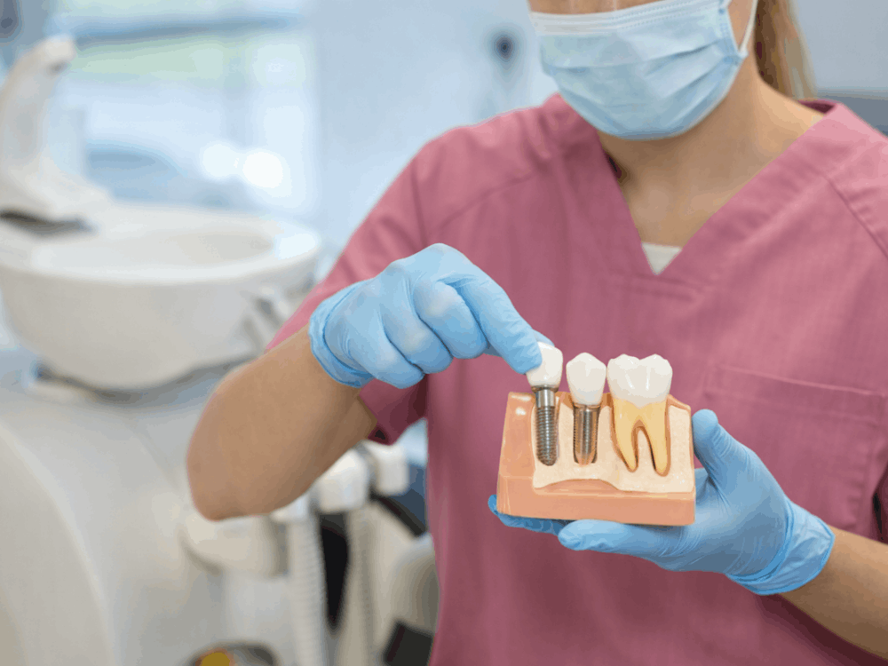 Tratamiento de implantes dentales en México