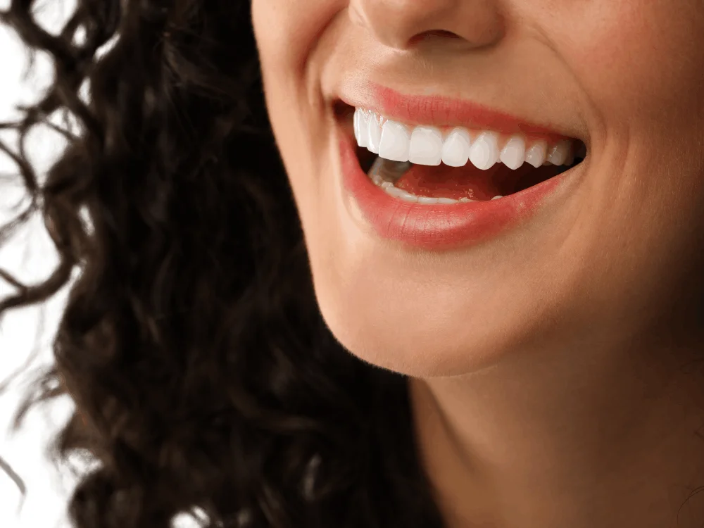 Dental Implants in Playa del Carmen