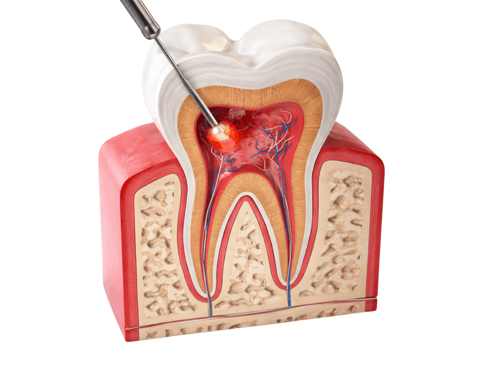 Especialista en endodoncia trabajando en Playa del Carmen
