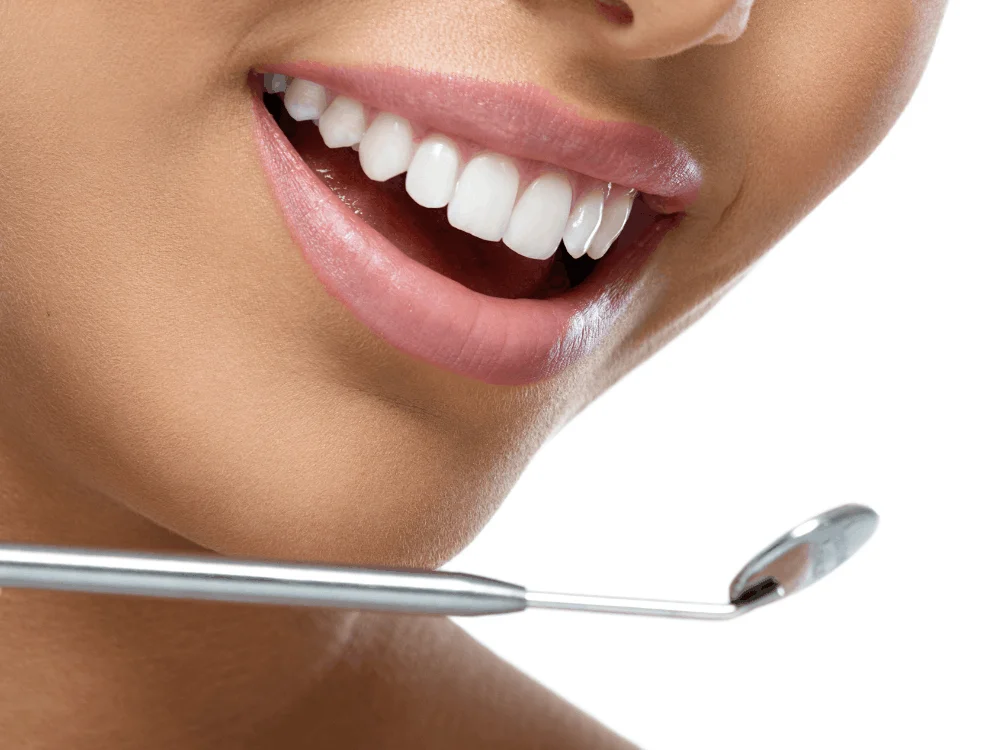 Actual Smile Design Results