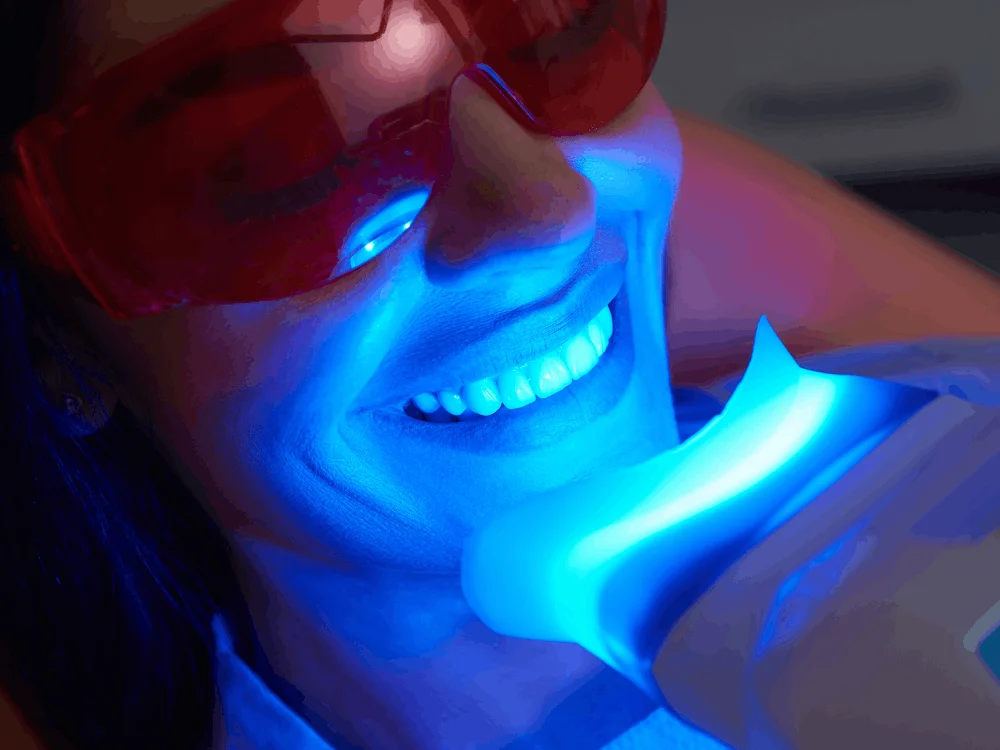 Professional teeth whitening treatment